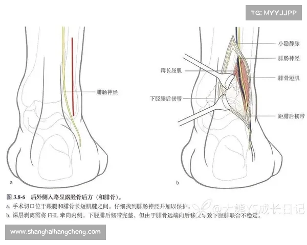 穆西亚拉腓骨骨折伴踝关节脱臼将接受手术并长期缺阵 穆西亚拉腓骨骨折伴踝关节脱臼将接受手术并长期缺阵